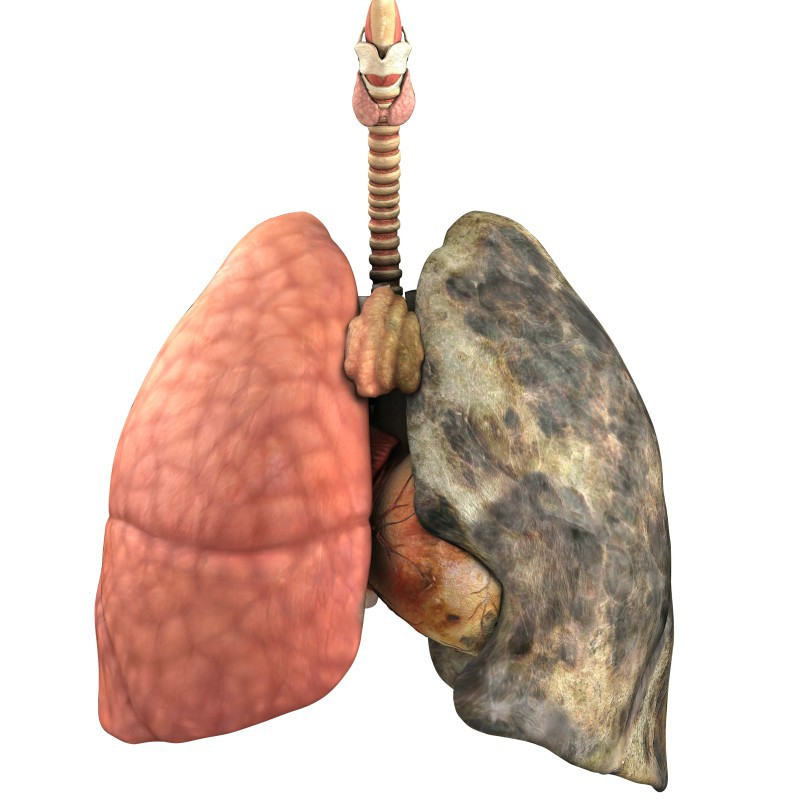 Emfizemul pulmonar. Cauza spirituală a bolii.