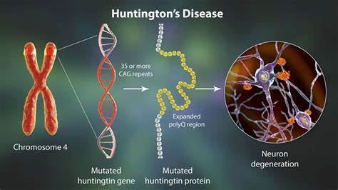 Boala lui Huntington numită și coreea ereditară. Totul din punct de vedere emoțional.