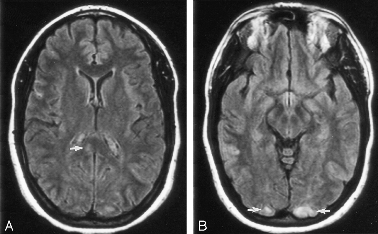 Alexie congenitala/Cecitatea verbală. Cauza emoțională.