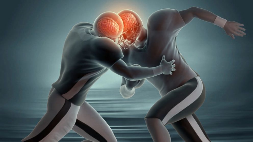 Creierul și comoția cerebrală. Din punct de vedere emoțional.