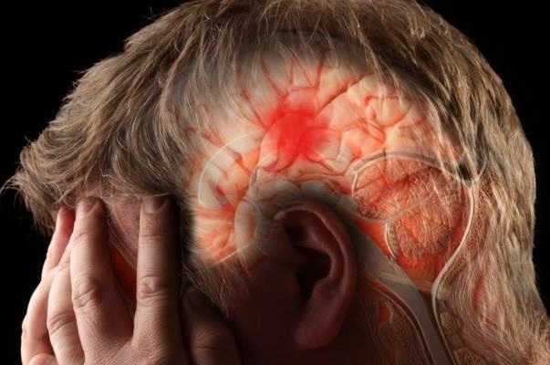 ACCIDENT VASCULAR CEREBRAL, mai pe scurt AVC. Totul din punct de vedere emoțional.