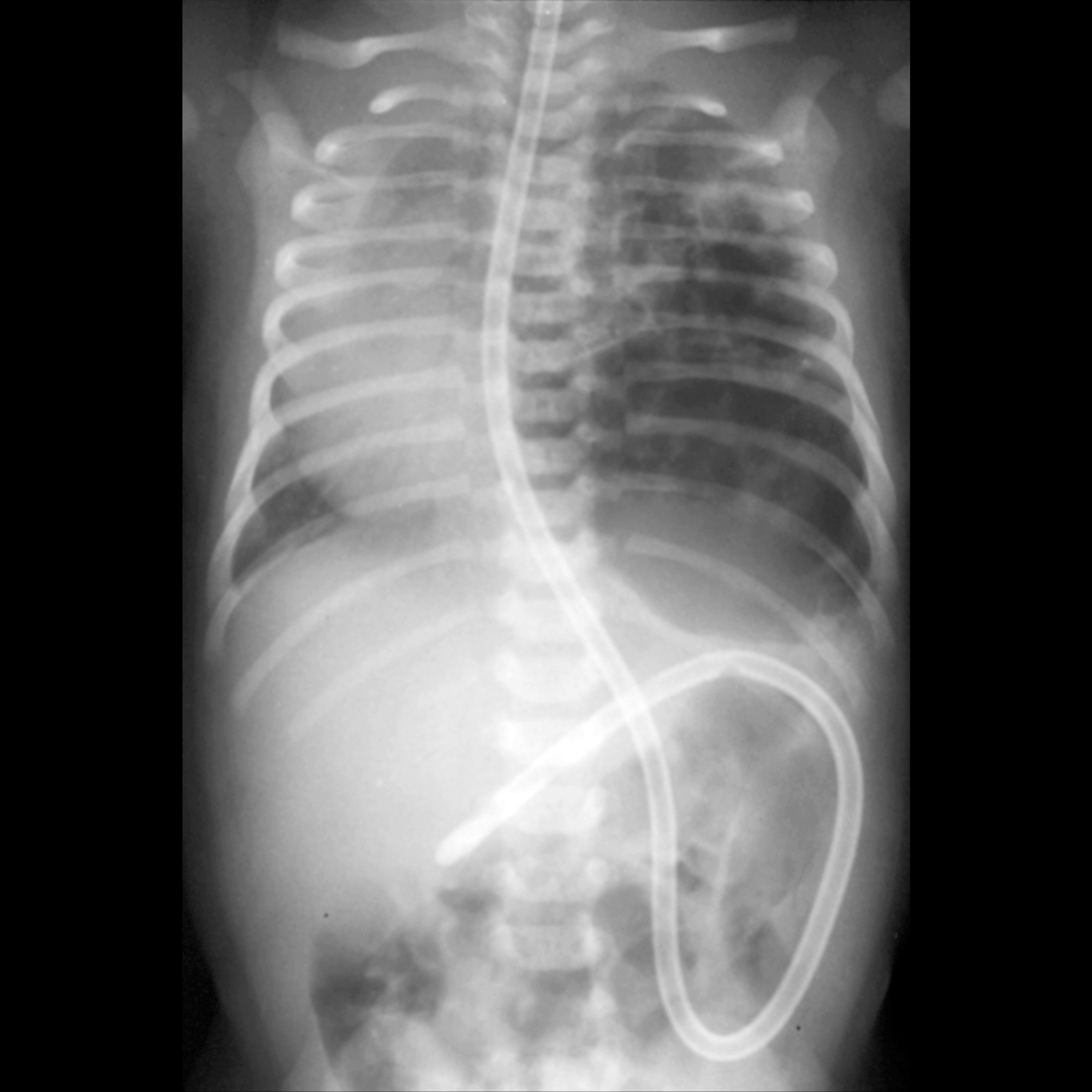 Malformația. Dezechilubru energetic și emoțional.