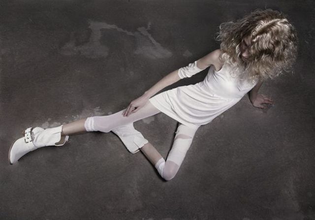 52.	Anorexie mentală