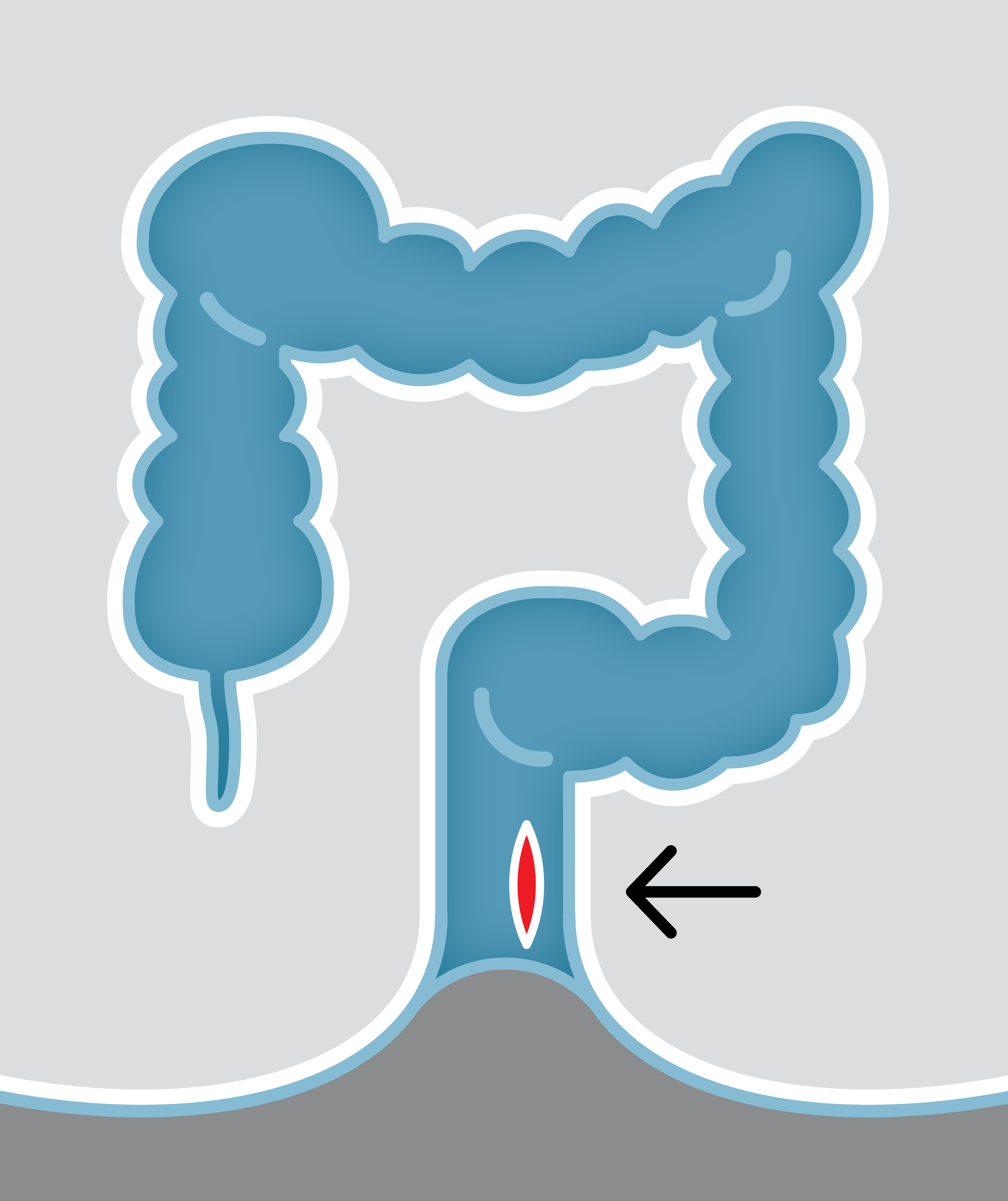 Fisuri anale. Cauza emoțională
