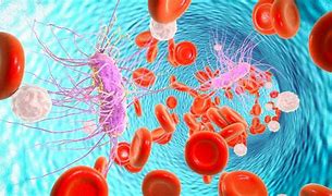 Septicimia