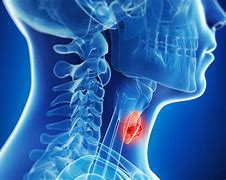 Cancerul la Laringe și emoțiile din spatele ei