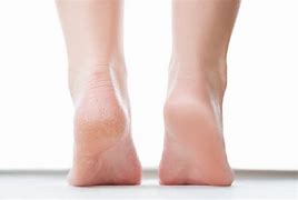 Călcâiul și cauzele spirituale