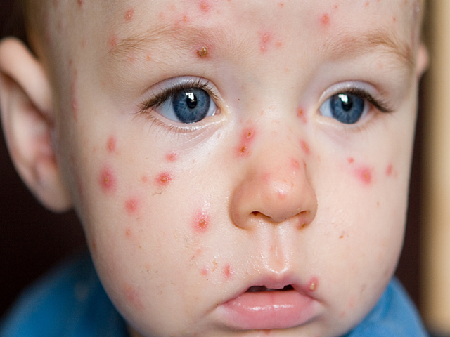 Bolile copilăriei și cauzele emoționale