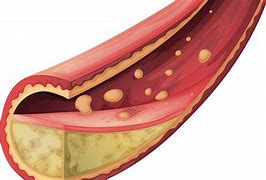 Colesterolul și circulația sângelui din punct de vedere emoțional