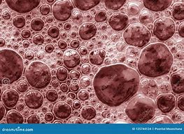 Boala lui Bright si cauza emoțională