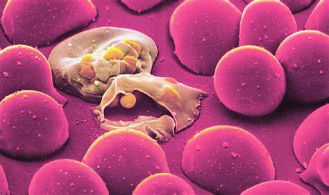 Malaria sau paludismul