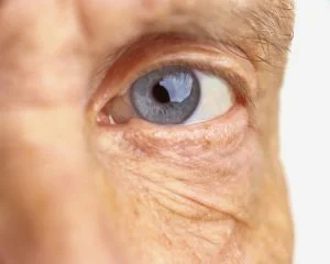 Hipermetropia și prezbitismul